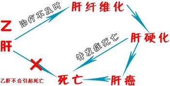 预防早期肝硬化需要做哪些