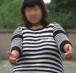 肥胖引起脂肪肝的治疗