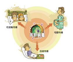 丙肝病毒隐藏深 好转丙肝需及时